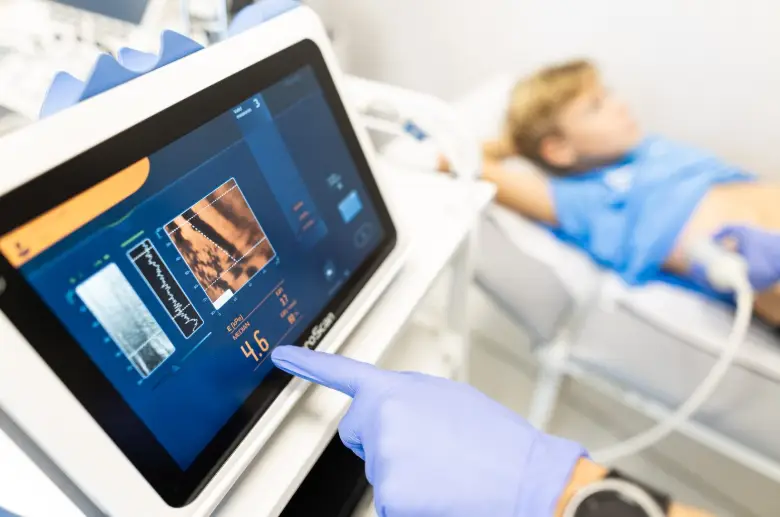 Ekran aparatu FibroScan z wynikiem pomiaru sztywności wątroby w kPa (E median)