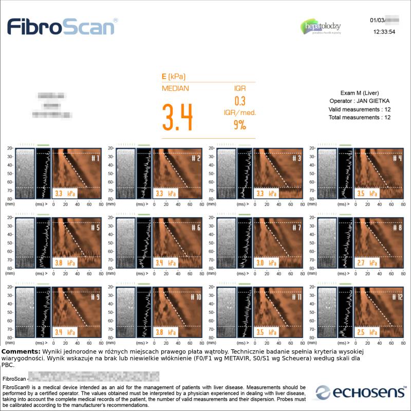 Przykładowy wynik badania elastograficznego wątroby aparatem FibroScan